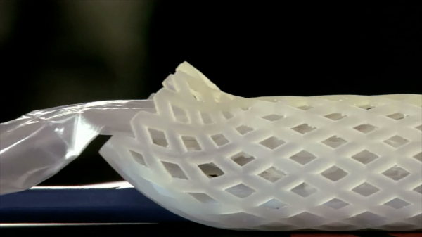 O implante que combate a obesidade