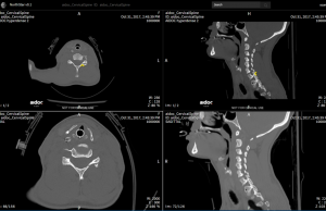 Entendendo o cérebro: pesquisa e tecnologia em Israel