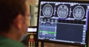 Sheba Medical Center realiza procedimento inovador para o tratamento de epilepsia